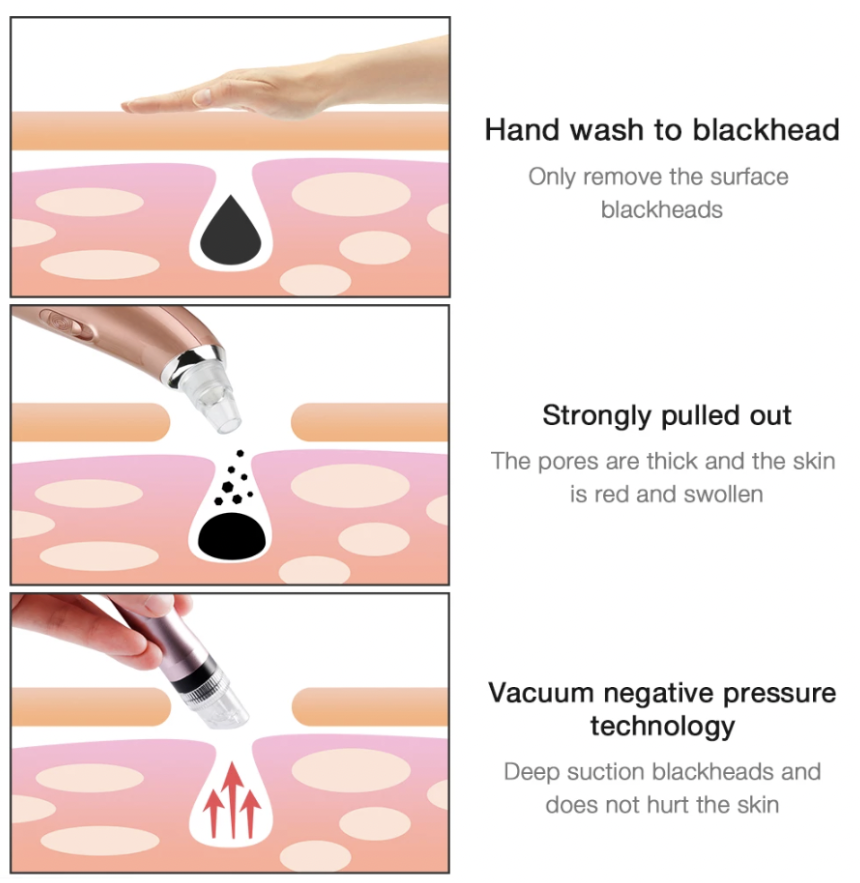 Aqua Peeling Portátil Hidrafacial