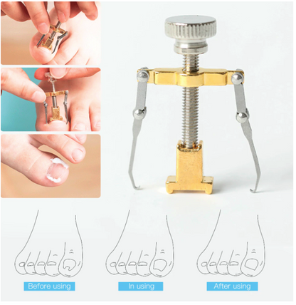 Kit Herramientas De Pedicura
