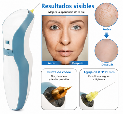 Plasma Pen - Profesional - Maclev