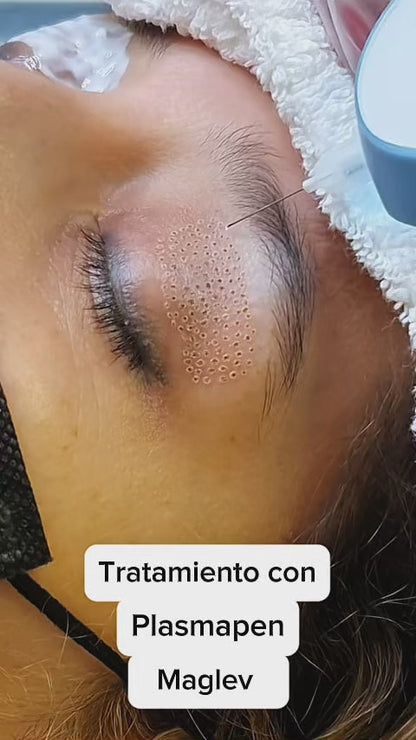 Plasma Pen - Profesional - Maclev